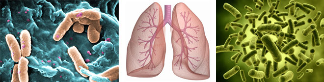 Lung-microbiome