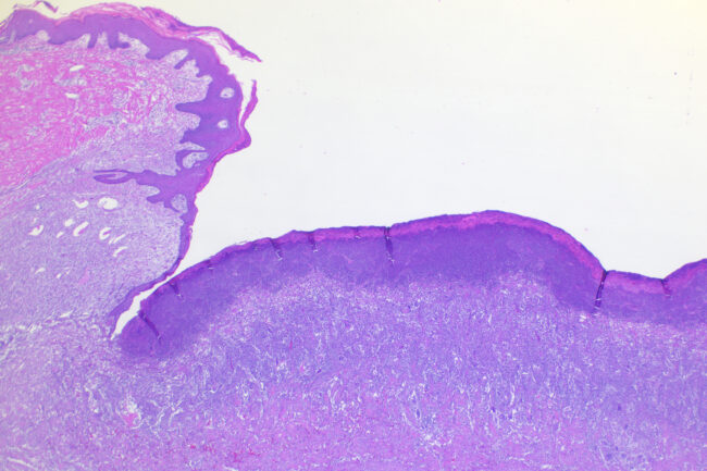24-1100 11-1 C2 2x