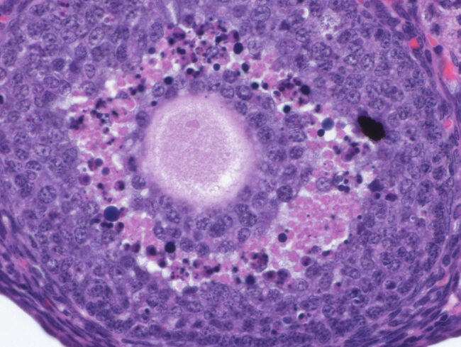 Apoptosis in Regressing Ovarian Follicle