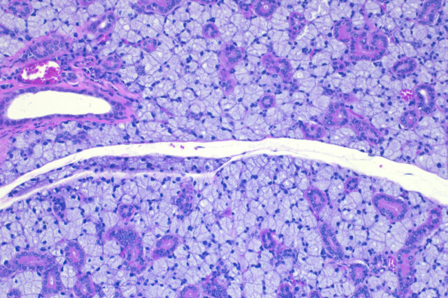 Sal Gland