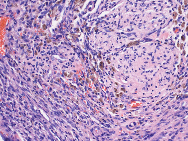 image_Nerve-200_x